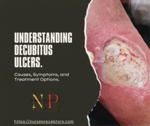 decubitus ulcer of a limb